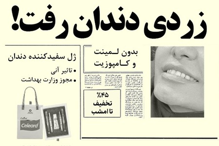 فرصت ویژه 45٪ تخفیف! دندان‌هاتو مثل کامپوزیت سفید کن!